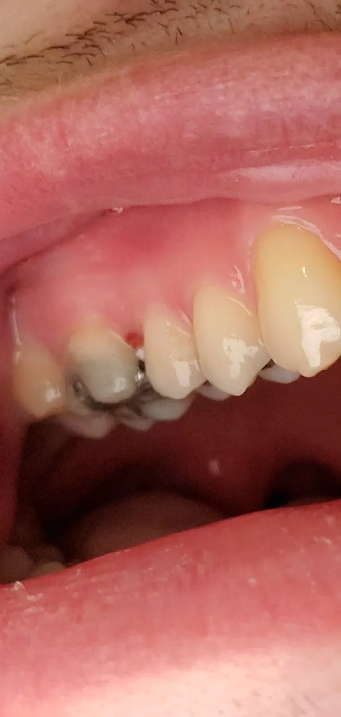 Shine Dental Picture 10