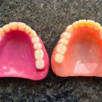 DENTOFIT DENTAL CLINIC - Top Dentist in Punawale IMPLANT | DENTAL | SKIN-HAIR (FIRST FLOOR u092au0939u093fu0932u093e u092eu091cu0932u093e)
