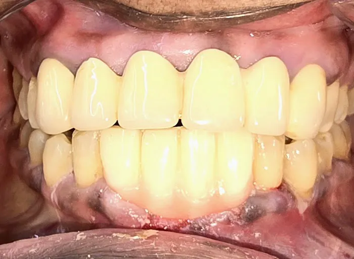 DENTOFIT DENTAL CLINIC - Top Dentist in Punawale IMPLANT | DENTAL | SKIN-HAIR (FIRST FLOOR पहिला मजला) Picture 2