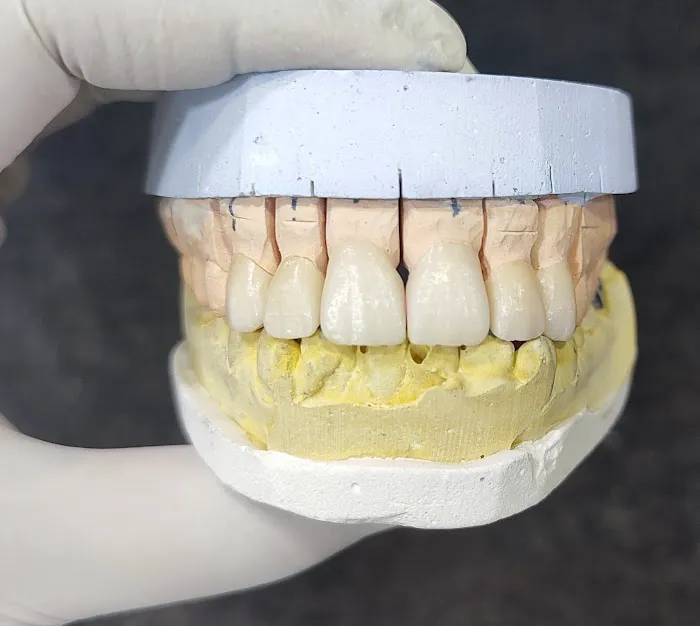 DENTOFIT DENTAL CLINIC - Top Dentist in Punawale IMPLANT | DENTAL | SKIN-HAIR (FIRST FLOOR पहिला मजला) Picture 3