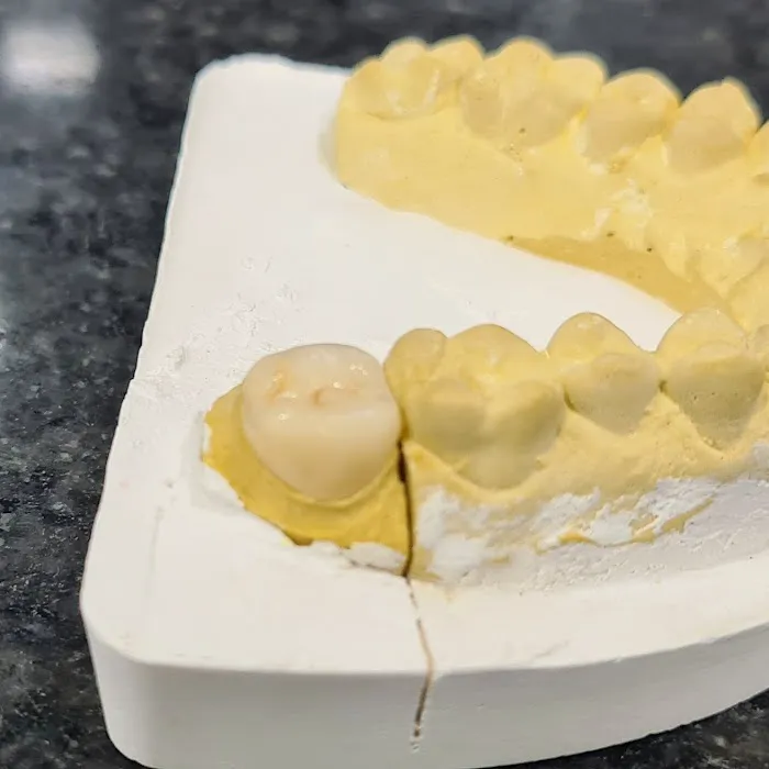 DENTOFIT DENTAL CLINIC - Top Dentist in Punawale IMPLANT | DENTAL | SKIN-HAIR (FIRST FLOOR पहिला मजला) Picture 6