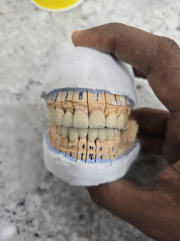 DENTOFIT DENTAL CLINIC - Top Dentist in Punawale IMPLANT | DENTAL | SKIN-HAIR (FIRST FLOOR पहिला मजला) Picture 9