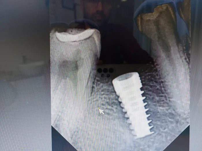 Khelkar’s Dent ‘O’ Spa Dental clinic Picture 6