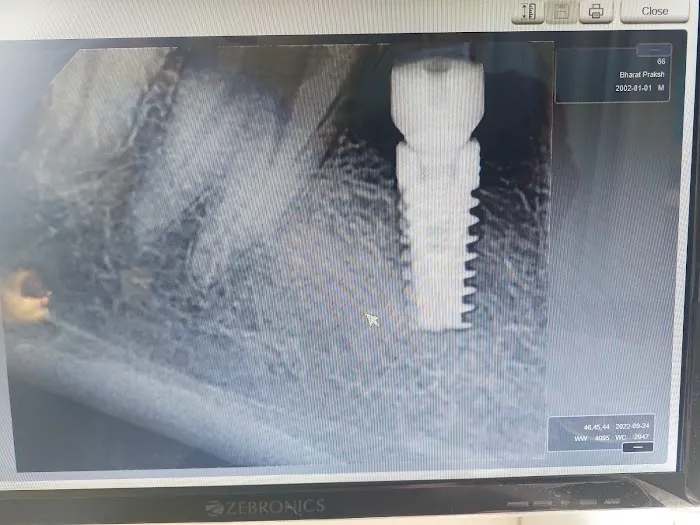 Khelkar’s Dent ‘O’ Spa Dental clinic Picture 9