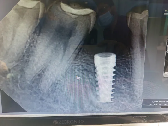Khelkar’s Dent ‘O’ Spa Dental clinic Picture 7