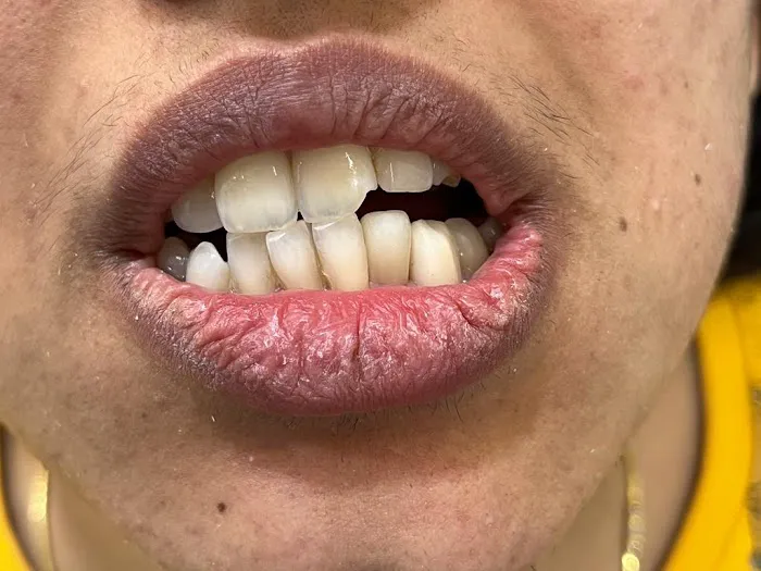 Darshil Dental Care - Best Dentist in Baner | Best Dental Clinic in Baner | RCT | Dental Implant Picture 8
