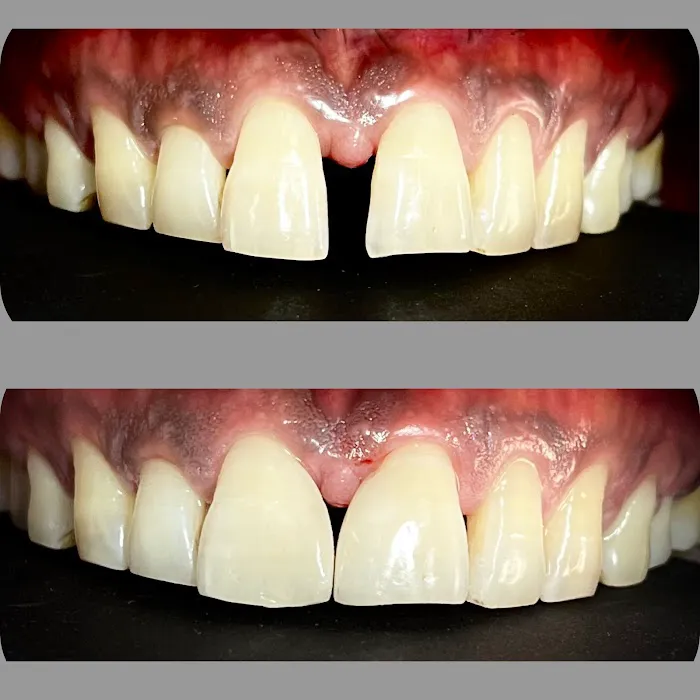 CAREDENT MULTISPECIALITY DENTAL CLINIC Picture 10