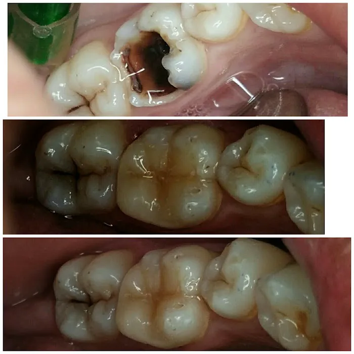 CAREDENT MULTISPECIALITY DENTAL CLINIC Picture 2