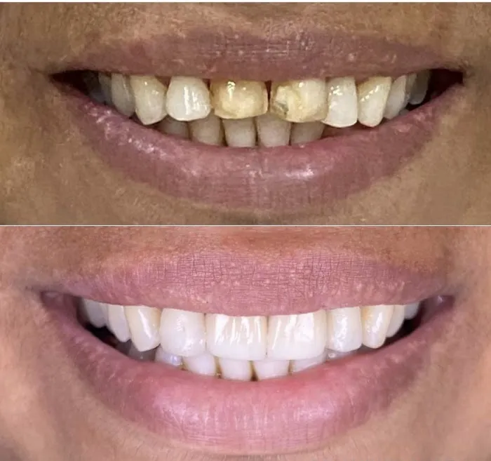CAREDENT MULTISPECIALITY DENTAL CLINIC Picture 6