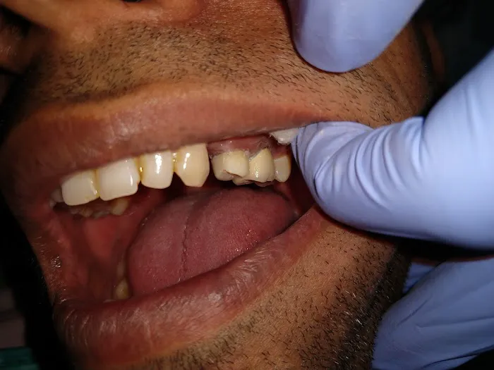 Cure Dent Dental Clinic (Implants /Braces/Invisalign) Picture 4