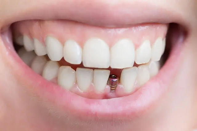 𝐏𝐀𝐓𝐈𝐋'𝐒 𝐃𝐄𝐍𝐓𝐀𝐋 𝐂𝐀𝐑𝐄 Picture 6