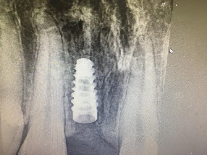 𝐏𝐀𝐓𝐈𝐋'𝐒 𝐃𝐄𝐍𝐓𝐀𝐋 𝐂𝐀𝐑𝐄 Picture 9