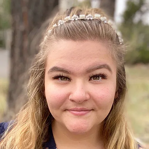 Flagstaff Smiles Picture 4