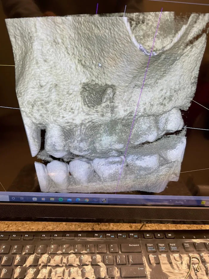 Ideal Dental Wylie Picture 6