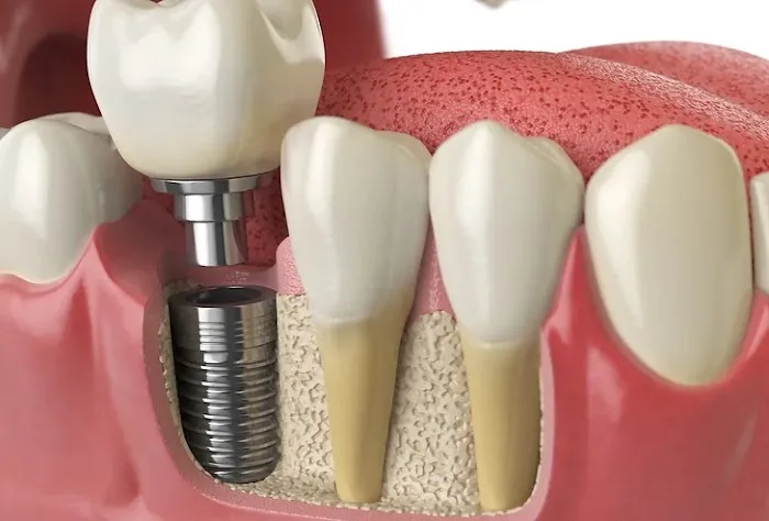 DentUrgent Picture 6