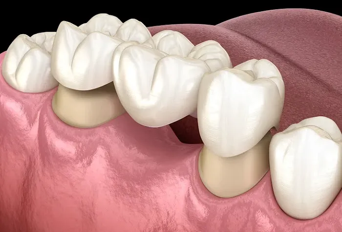 DentUrgent Picture 3