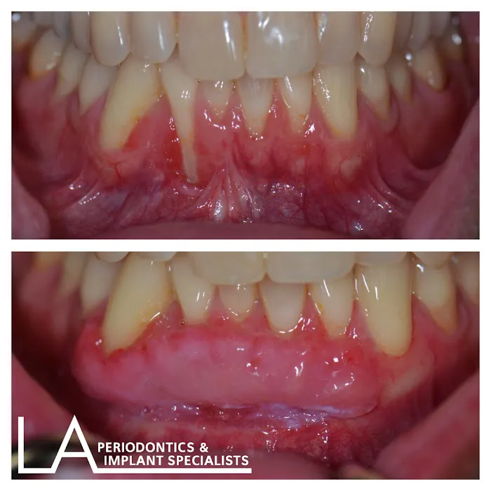 LA Periodontics & Implant Specialists Picture 4