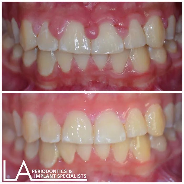 LA Periodontics & Implant Specialists Picture 1