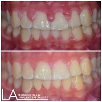 LA Periodontics & Implant Specialists ico