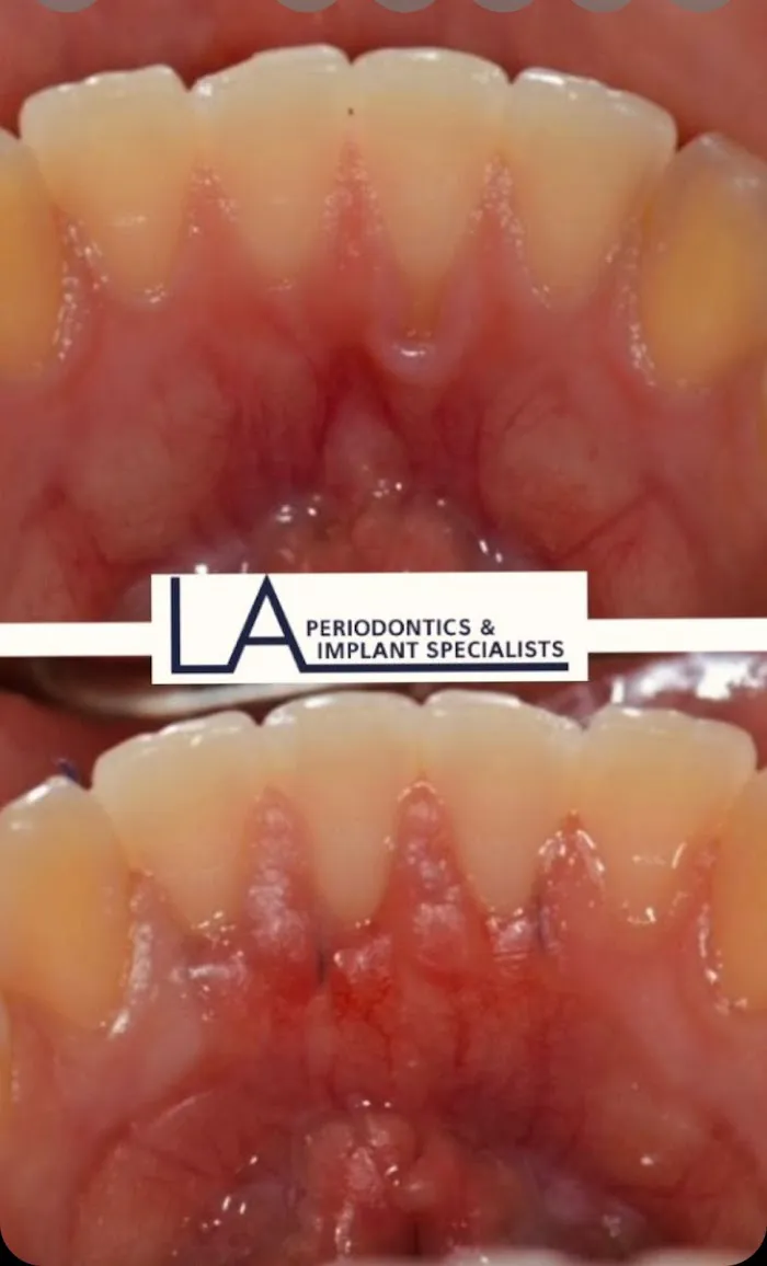 LA Periodontics & Implant Specialists Picture 3