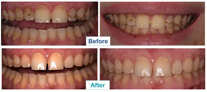 Dr. Kevin Kang, DDS: Cosmetic Dentistry & Clear Aligners Picture 4