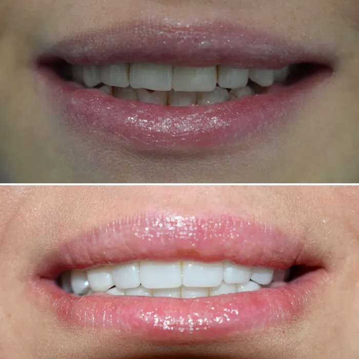 Elite Dental Group Andre Eliasian DDS Picture 9