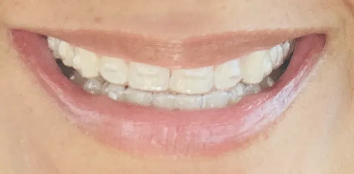 Parkview Dental Picture 1