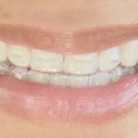 Parkview Dental ico