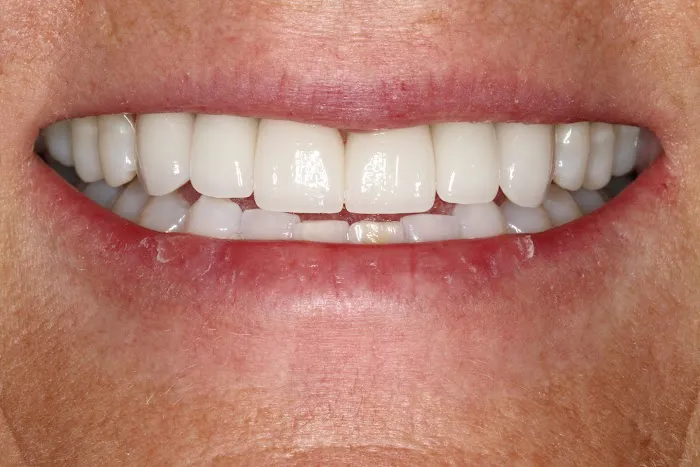 Telluride Center for Dentistry - Telluride Dental Picture 2