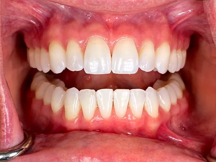 SmileWell Dental - Jeanine M. Sasek, DDS Picture 8