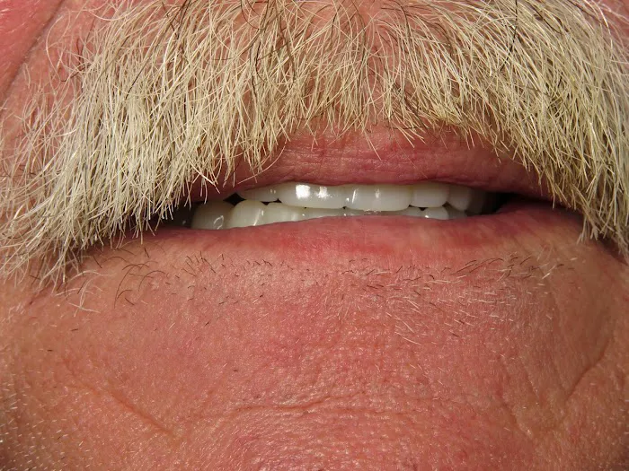 All-In-One Dental Picture 7