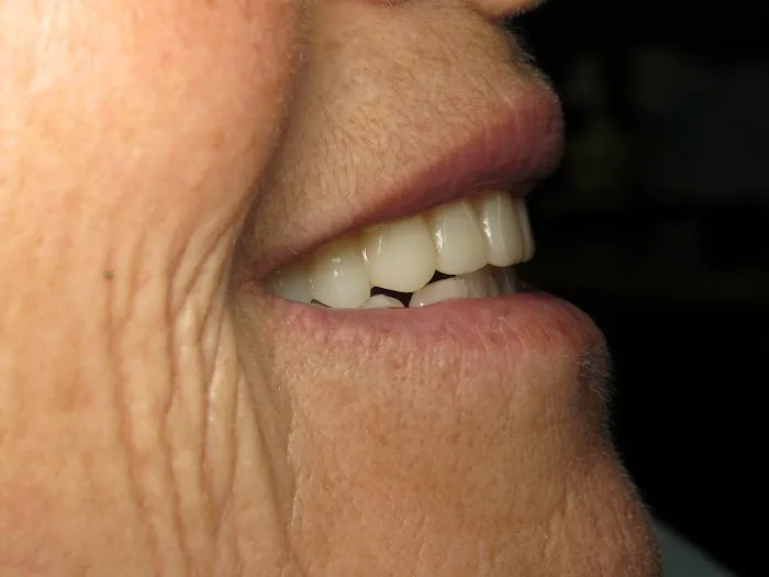 All-In-One Dental Picture 9