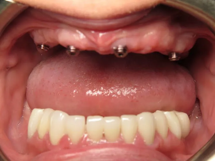All-In-One Dental Picture 3