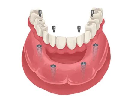 La Costa Family Dental and Implant Center