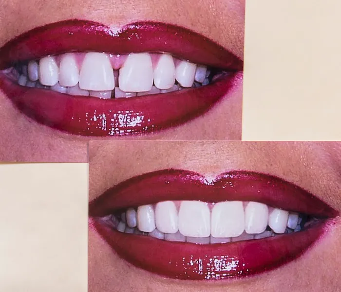 New Age Dental Care Picture 2