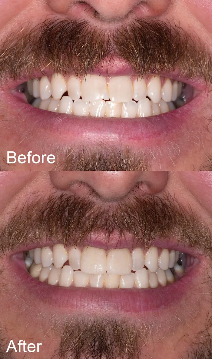 Dental Partners of Creve Coeur Picture 3