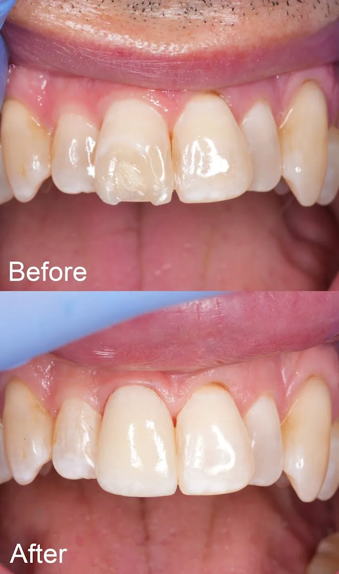Dental Partners of Creve Coeur Picture 4