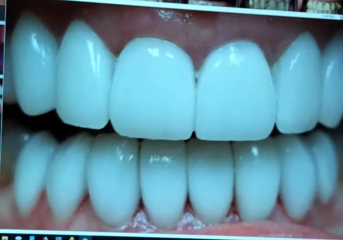 Discover Dentistry of Sachse Picture 9