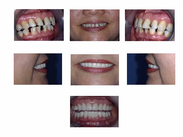 Plano Dental Excellence Picture 8