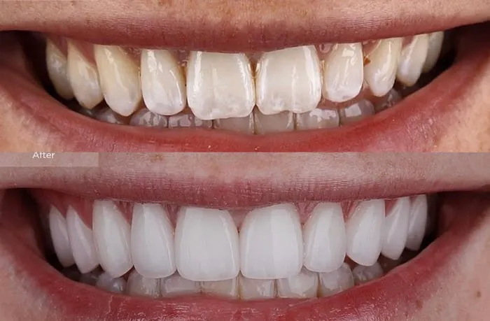 Smile Care Valencia - Robert P. Hedvat, DDS Picture 2