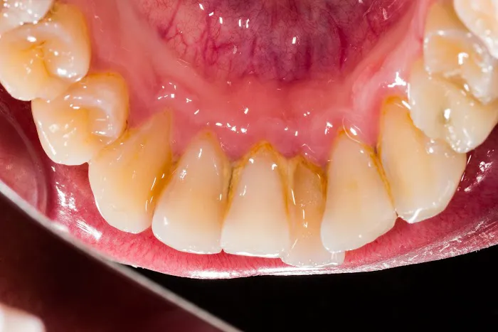 Kingston Dental Care in St. Louis, MO Picture 3