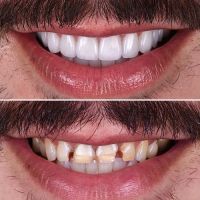 Newhall Dental Arts ico