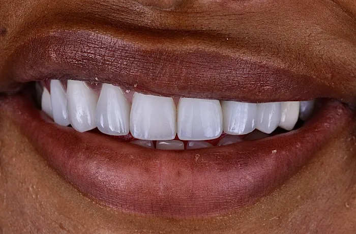 Newhall Dental Arts Picture 5