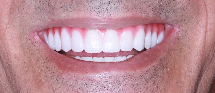 Perfect Smiles Dental Studio Picture 2