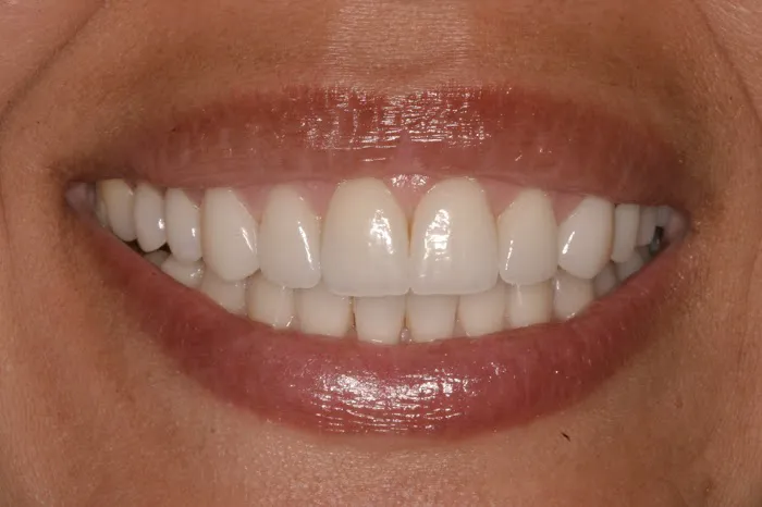 Water Tower Dental Care Picture 3