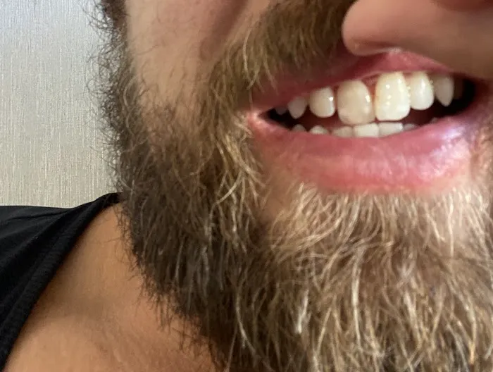 DentArt Chicago Picture 5