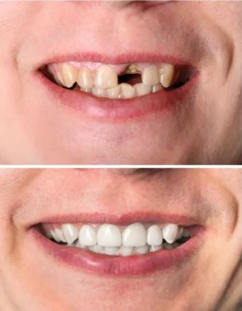 Cedaredge Dental Clinic Picture 4