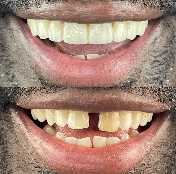 Diamond Dental Spa Dentist in Woodland Hills Picture 8