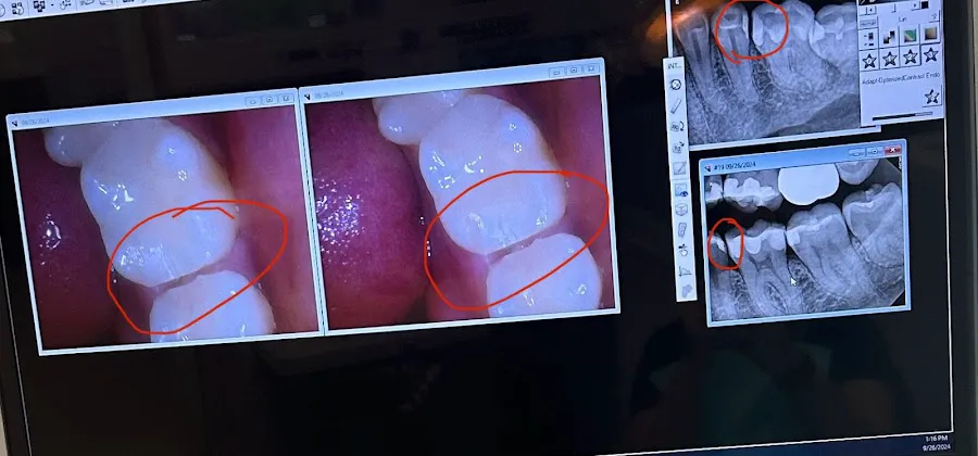 Middletown Commons Family Dental Picture 4