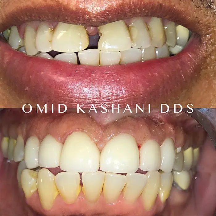 Cosmetic Dental Care of Santa Monica Picture 1
